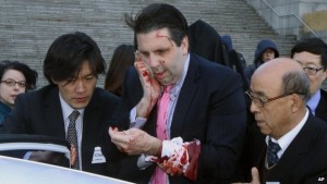 US ambassador to South Korea Mark Lippert covers a wound to his face as he leaves the Sejong Cultural Institute after he was injured in an attack by an armed assailant