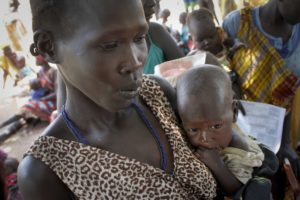  Elizabeth Athiel holds her 8-month-old malnourished daughter Anger, at a UNICEF clinic in Aweil, South Sudan. Friday, Sept. 16, 2016.