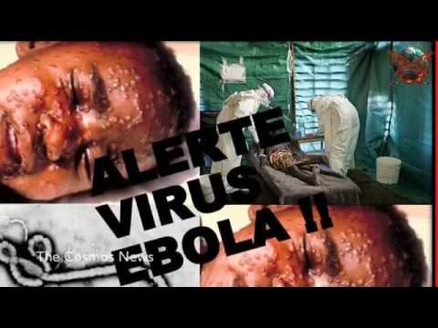 What is the Ebola virus, and how worried should we be?